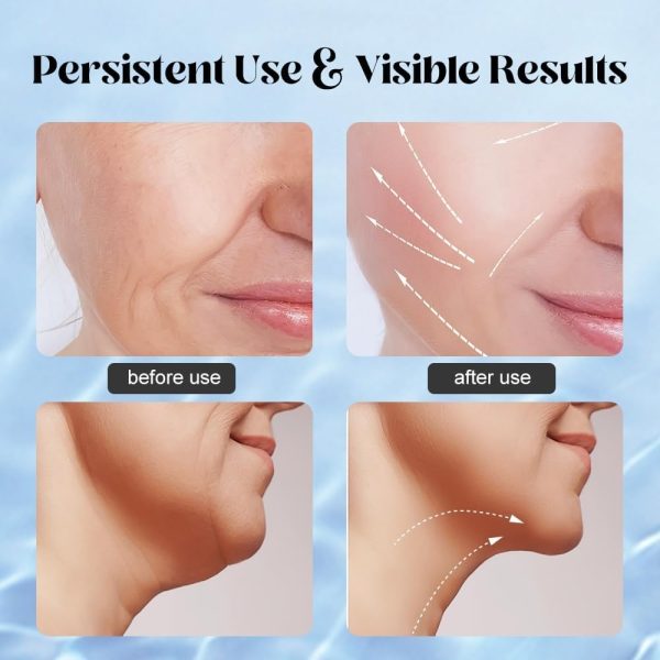 All Round import Lifting Facial Massagers beauty Instrument