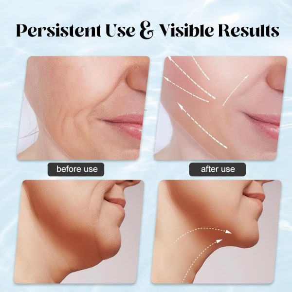 All Round import Lifting Facial Massagers beauty Instrument